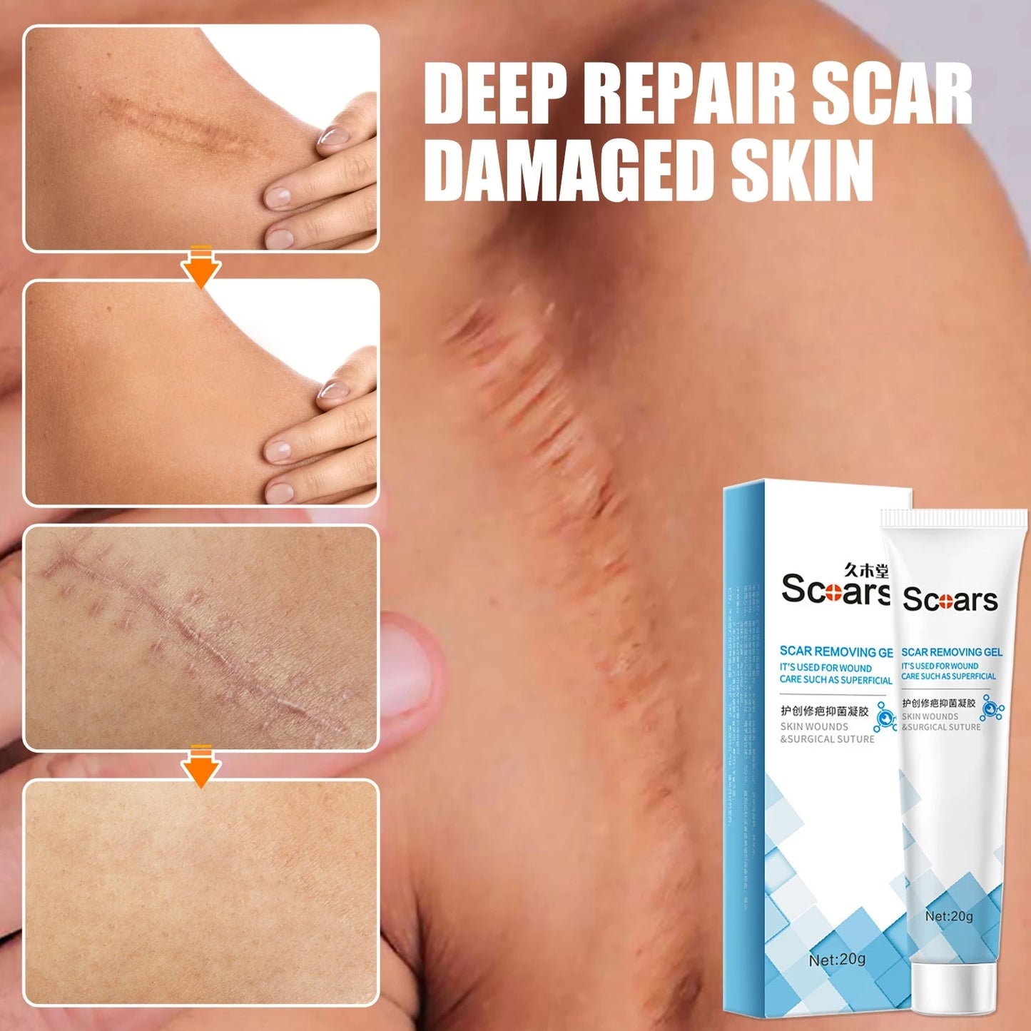 Delve™ New Herbal Scar Repair Cream