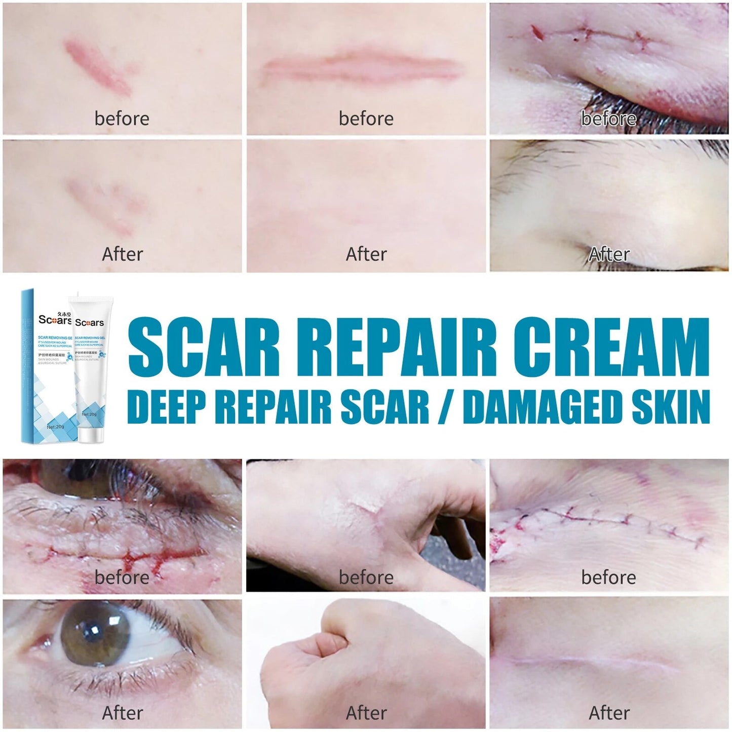 Delve™ New Herbal Scar Repair Cream