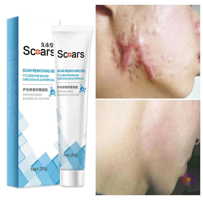 Delve™ New Herbal Scar Repair Cream