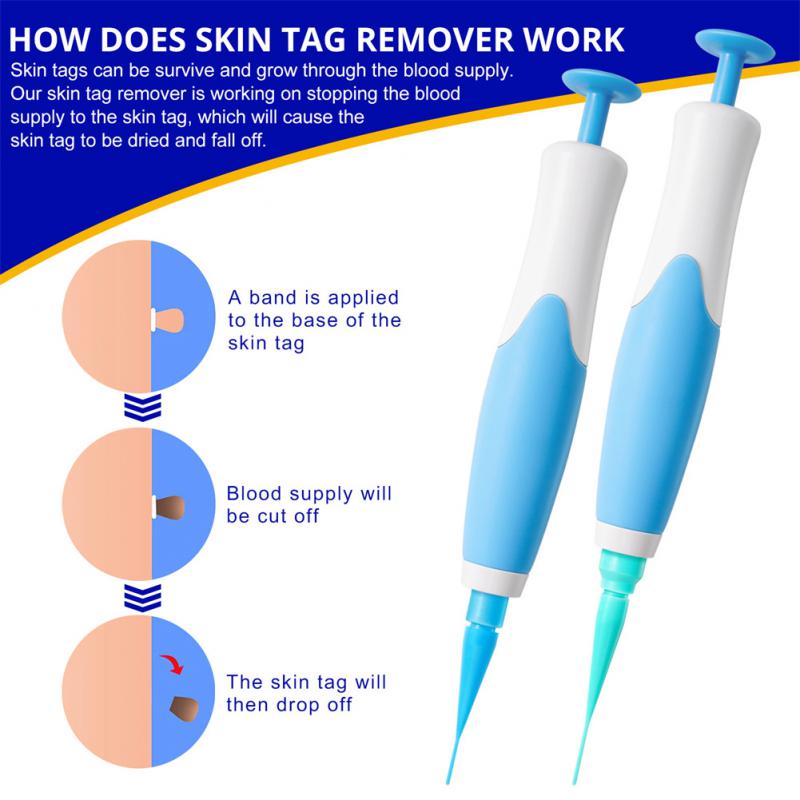 Delve™ Auto Skin Tag Removal Kit