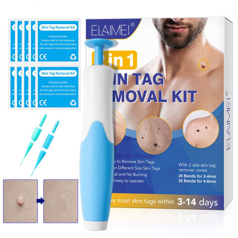 Delve™ Auto Skin Tag Removal Kit