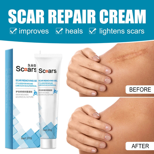 Delve™ New Herbal Scar Repair Cream